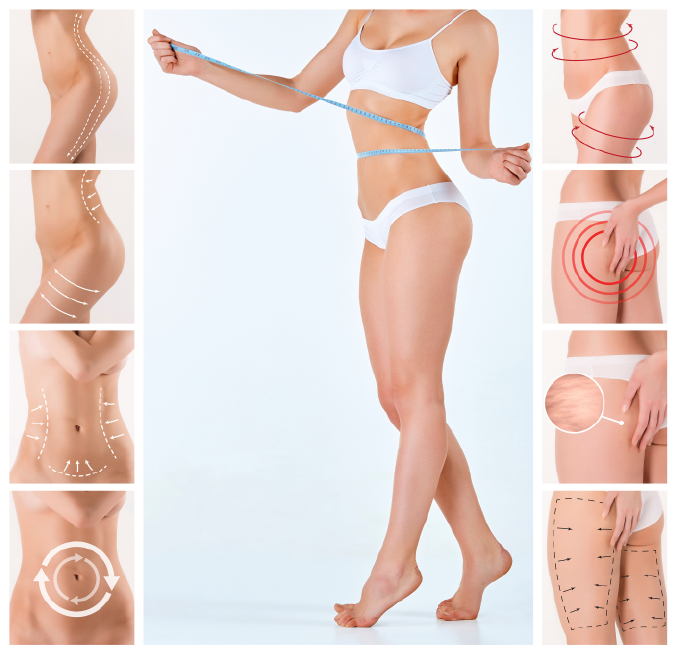 Lipoescultura y Liposucción