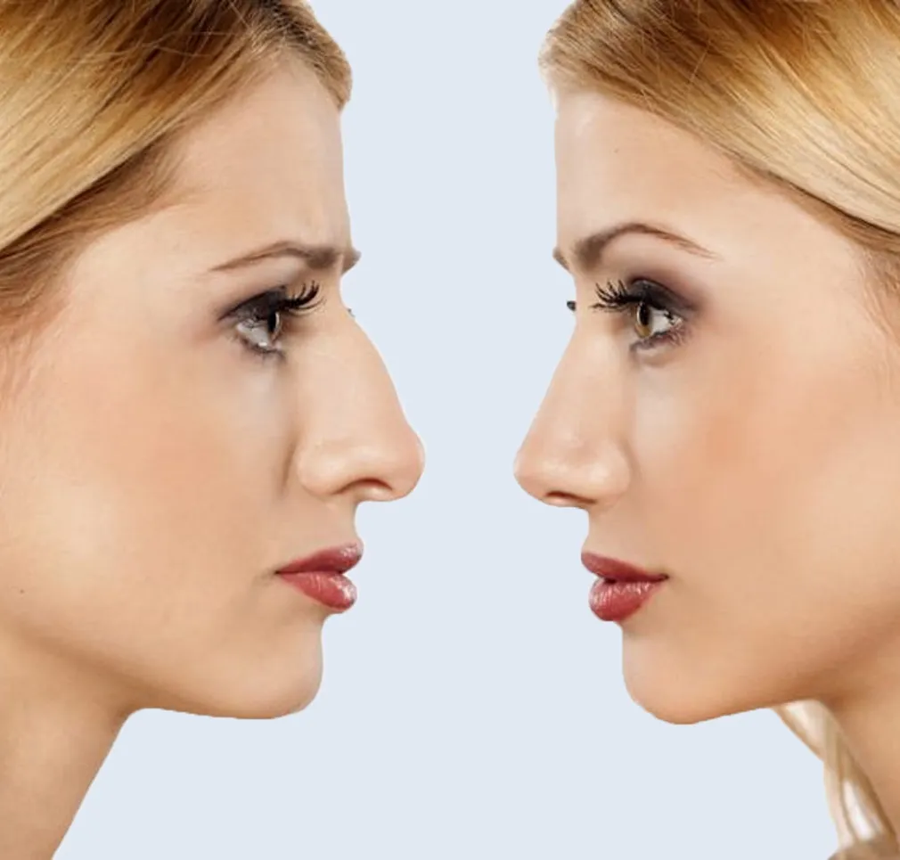 Estética Facial